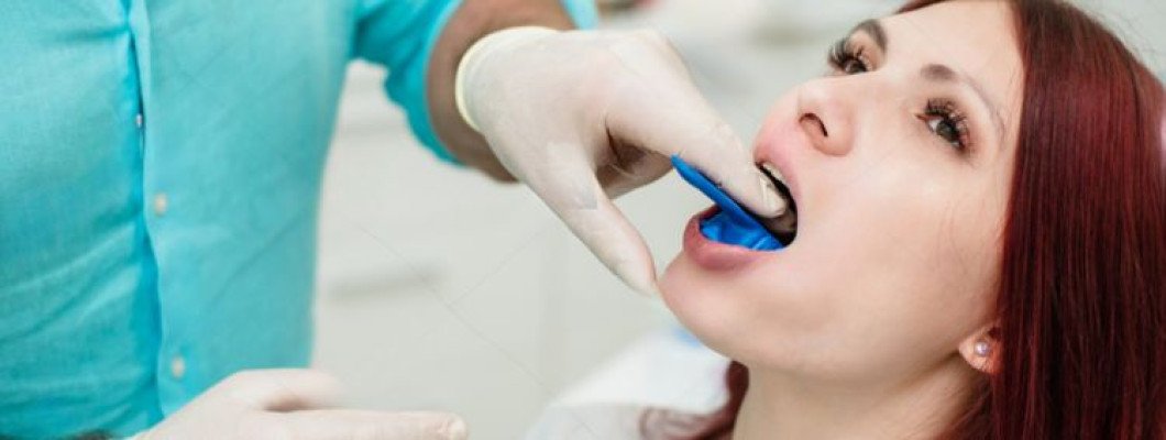 The Foundation of Accurate Dental Impressions The Foundation of Accurate Dental Impressions